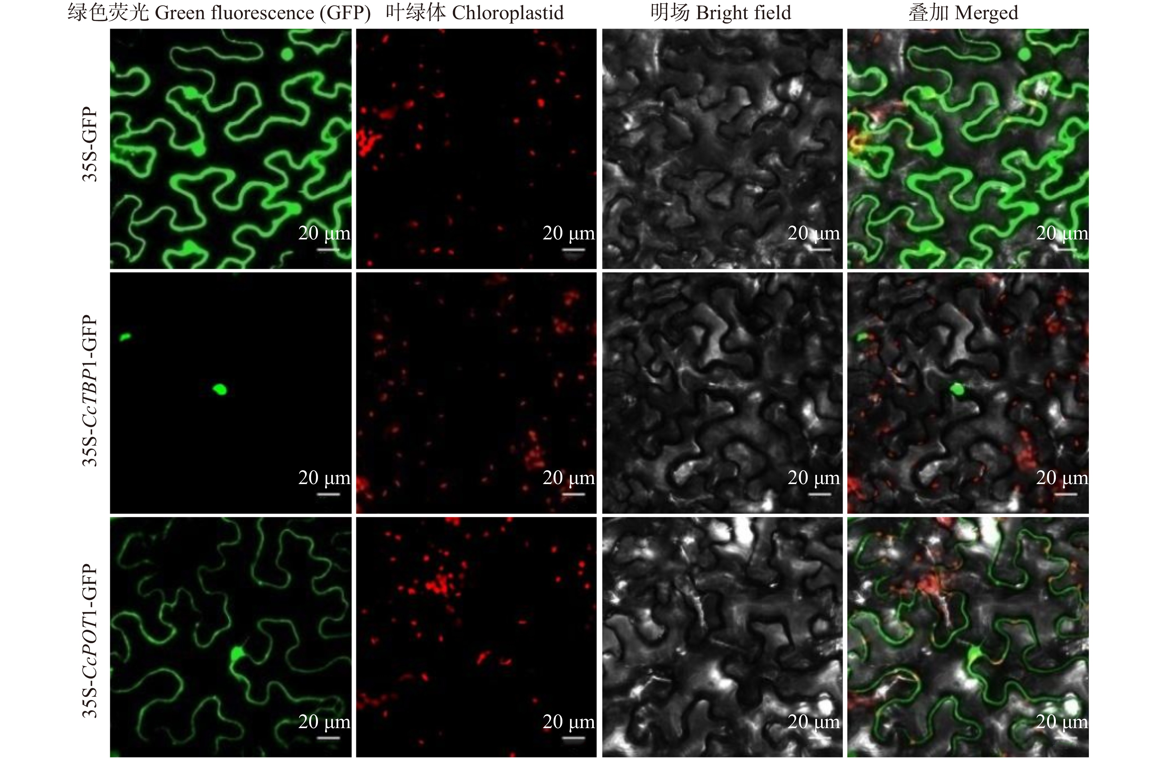 Cloning Subcellular Localization And Expression Analysis Of Telomere Genes Cctbp 1 And Ccpot 1